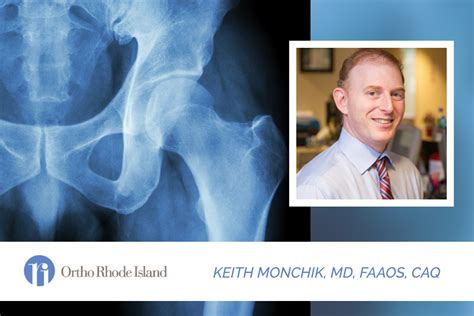 hip replacement rhode island|ortho hip specialist.